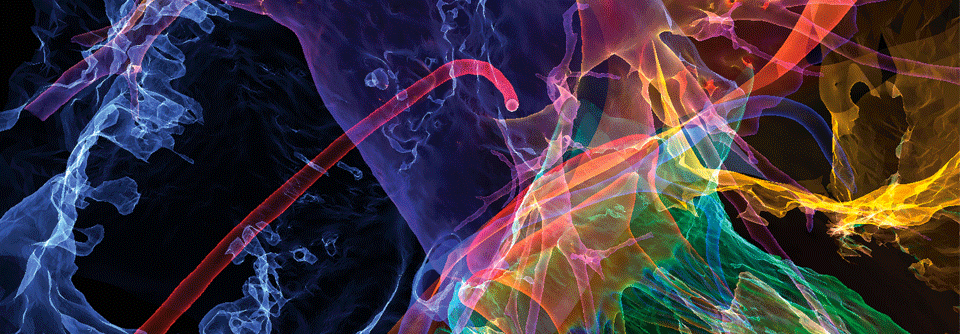 Mutet in dieser 3D-CT-Darstellung futuristisch an, ist heutzutage aber ein Standardeingriff: die Pulmonalvenenisolation. In Deutschland hat sich die Zahl der Ablationen im Schnitt alle fünf Jahre verdoppelt.