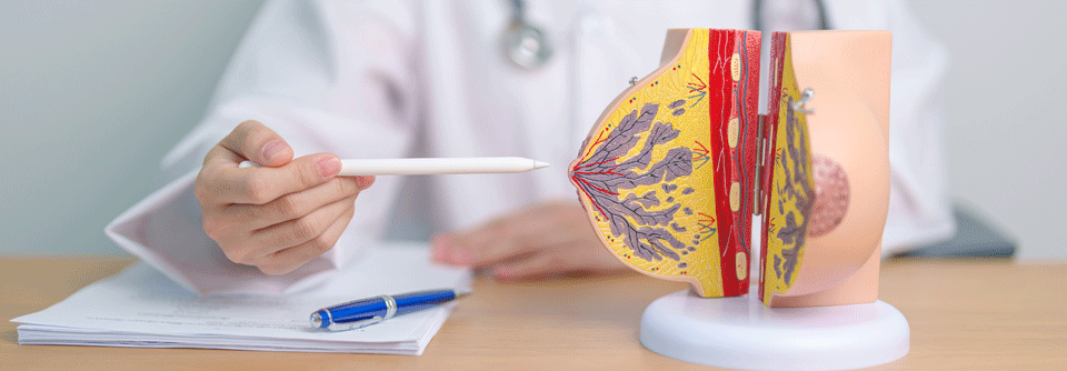 Eine ergänzende Sonographie verbessert die Brustkrebs-Früherkennung bei Frauen mit dichtem Brustdrüsengewebe.