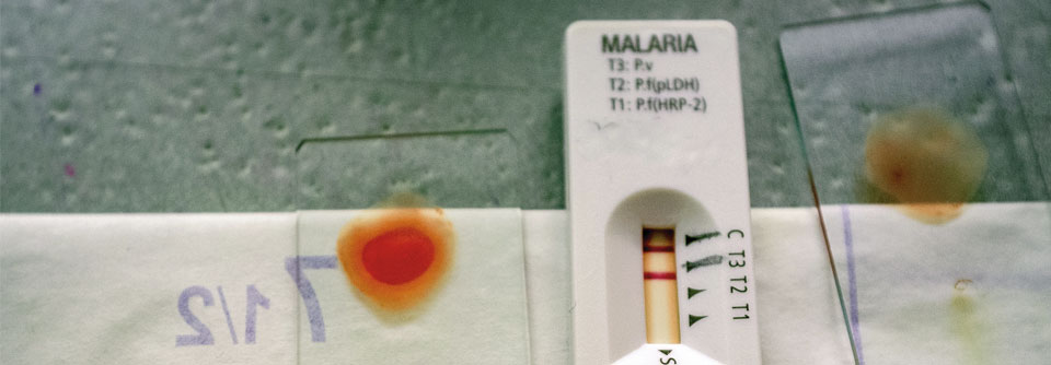 Malaria Schnelltest.